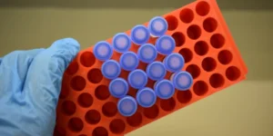 Colloidal Gold Immunochromatography